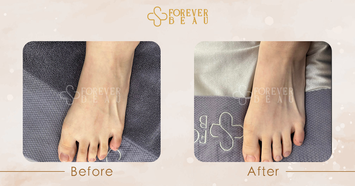 ForeverBeau_BeforeAfter_3