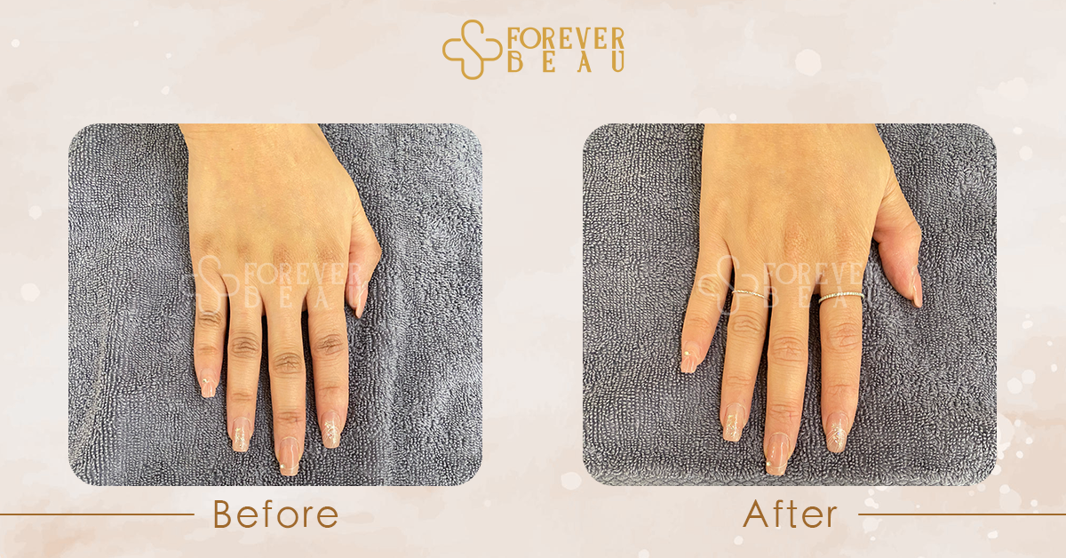 ForeverBeau_BeforeAfter_4