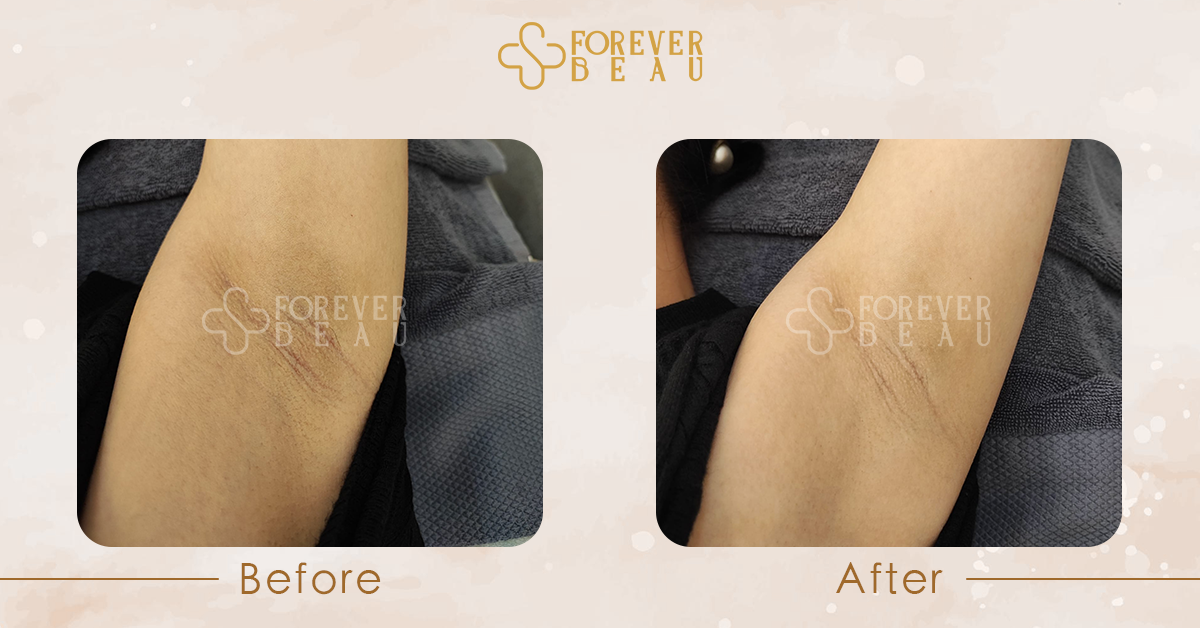 ForeverBeau_BeforeAfter_5