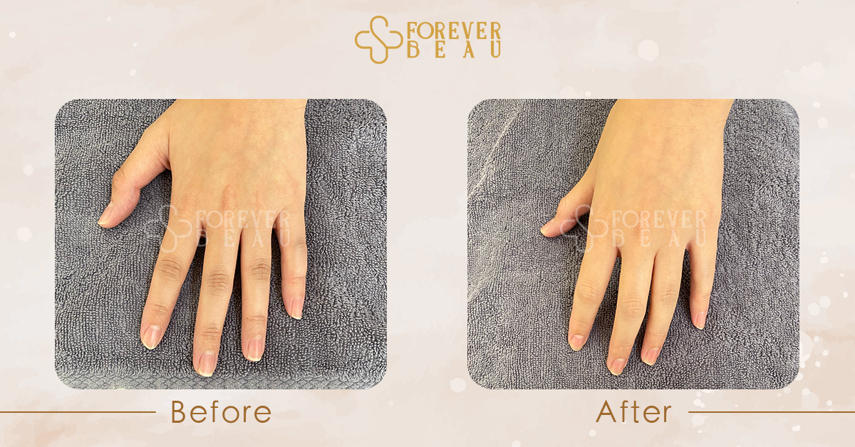 ForeverBeau_BeforeAfter_6