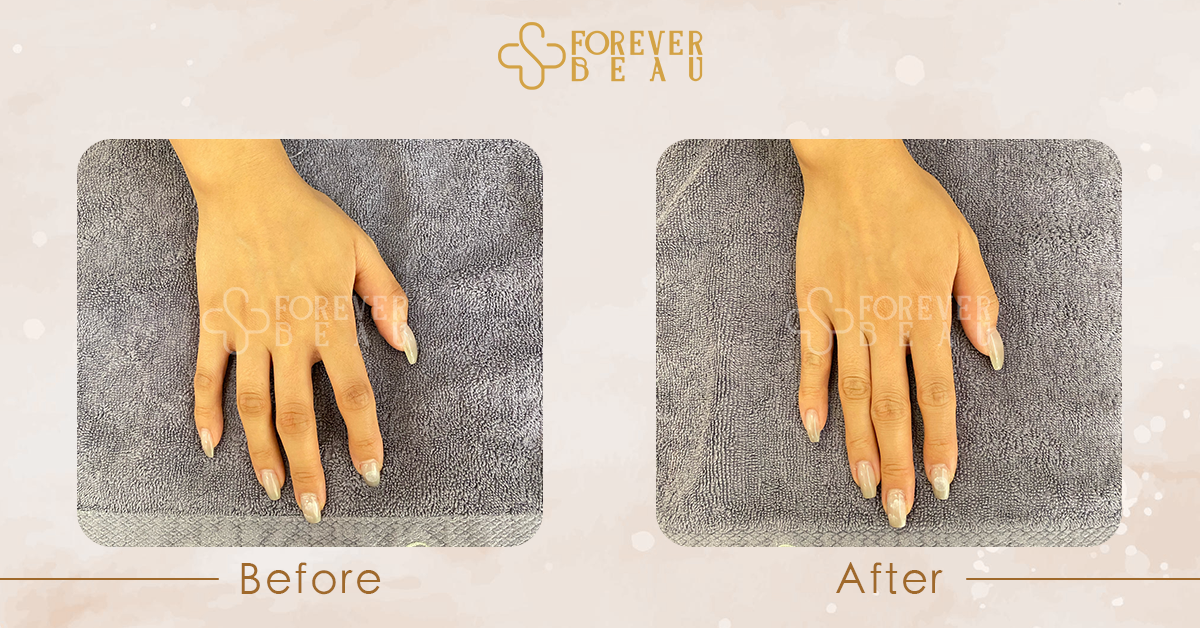 ForeverBeau_BeforeAfter_7