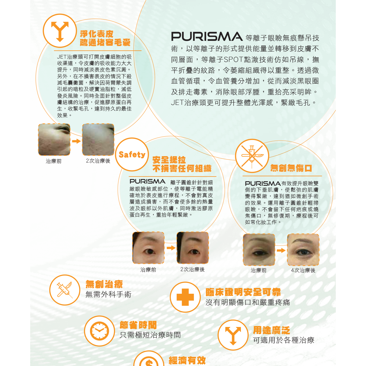 PURISMA 等離子眼瞼無痕懸吊:圖片 4