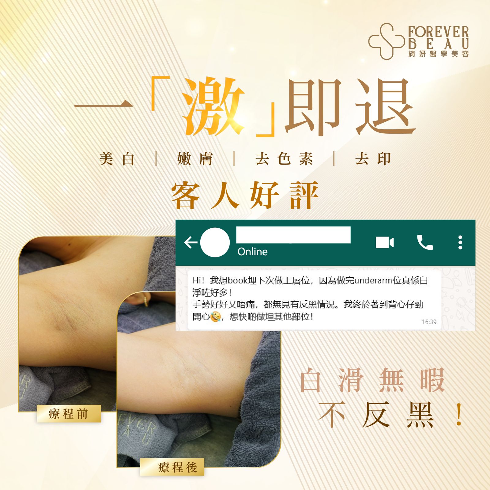 「激」退色素 皇牌獨家療程:圖片 3