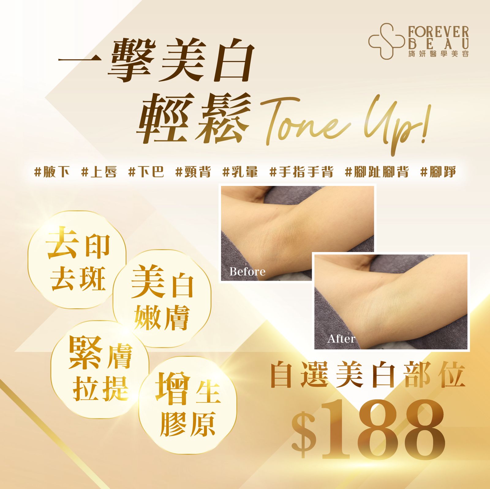 「激」退色素 皇牌獨家療程:圖片 5