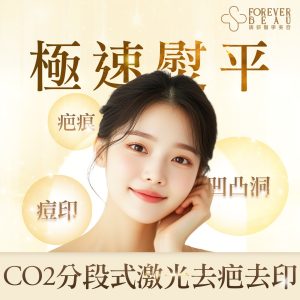 CO2分段式激光去疤去印